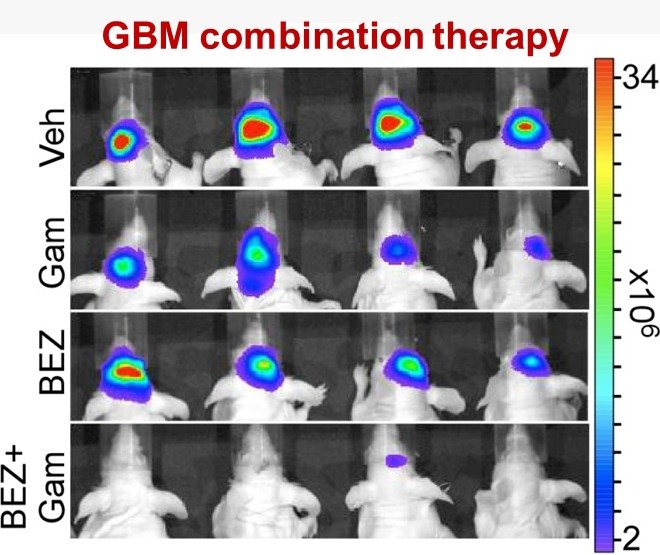 GBM Combination Therapy